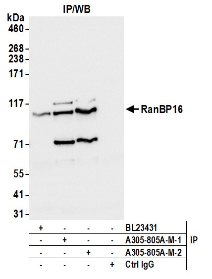 RanBP16 Antibody in Immunoprecipitation (IP)