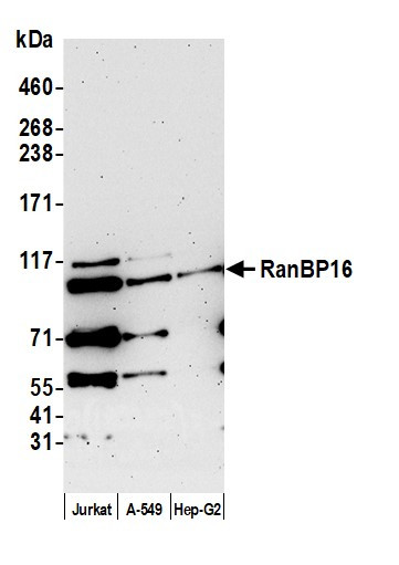 RanBP16 Antibody in Western Blot (WB)