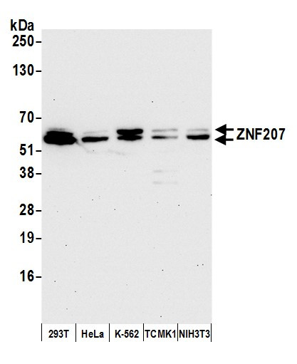 ZNF207 Antibody in Western Blot (WB)