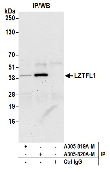 LZTFL1 Antibody in Immunoprecipitation (IP)