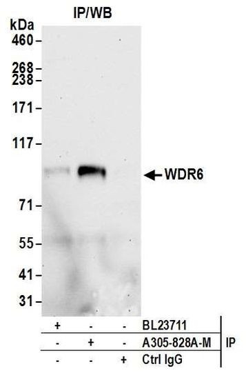 WDR6 Antibody in Immunoprecipitation (IP)