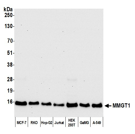 MMGT1 Antibody in Western Blot (WB)