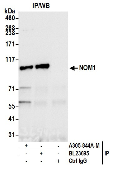 NOM1 Antibody in Immunoprecipitation (IP)