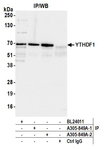 YTHDF1 Antibody in Immunoprecipitation (IP)