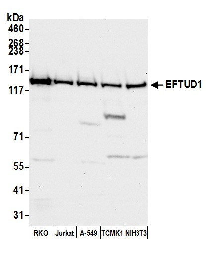 EFTUD1 Antibody in Western Blot (WB)