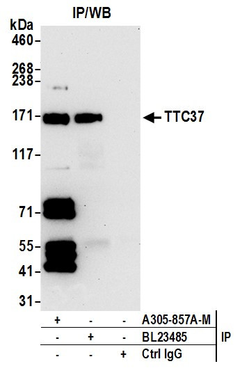 TTC37 Antibody in Immunoprecipitation (IP)