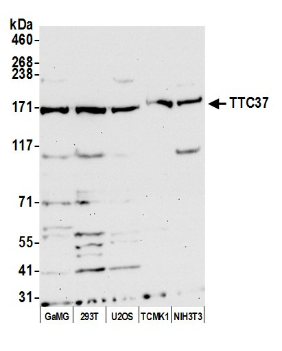 TTC37 Antibody in Western Blot (WB)