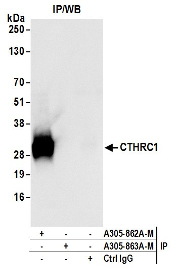 CTHRC1 Antibody in Immunoprecipitation (IP)