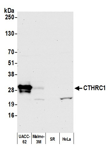 CTHRC1 Antibody in Western Blot (WB)