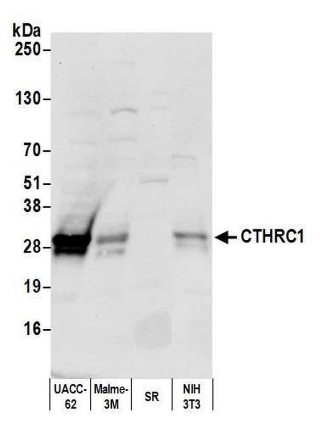 CTHRC1 Antibody in Western Blot (WB)