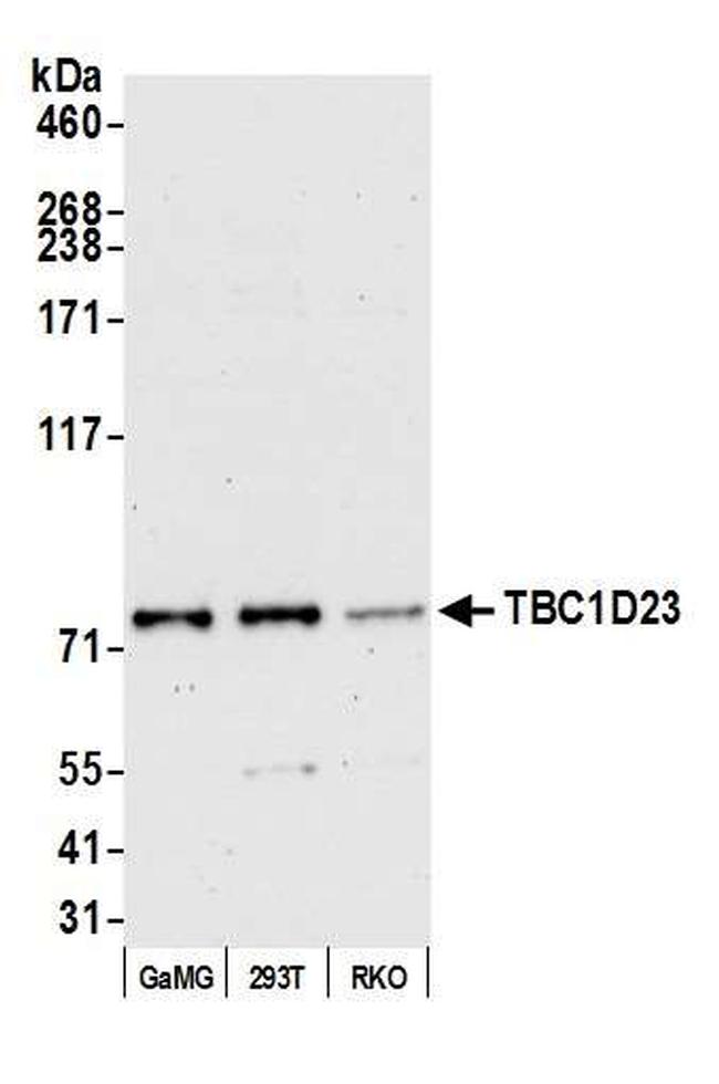 TBC1D23 Antibody in Western Blot (WB)