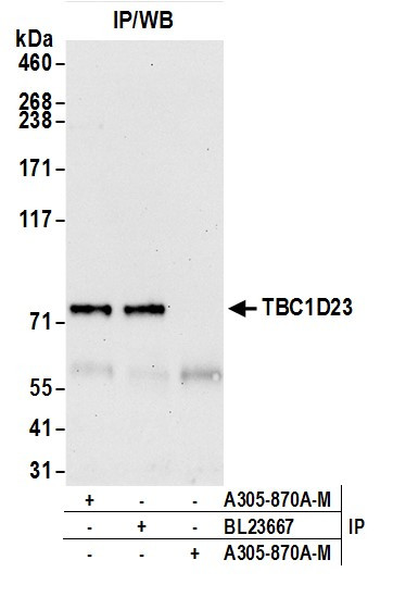 TBC1D23 Antibody in Immunoprecipitation (IP)
