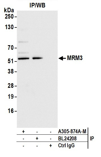 MRM3 Antibody in Immunoprecipitation (IP)