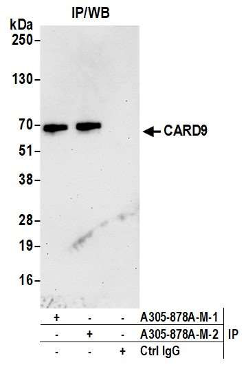 CARD9 Antibody in Immunoprecipitation (IP)