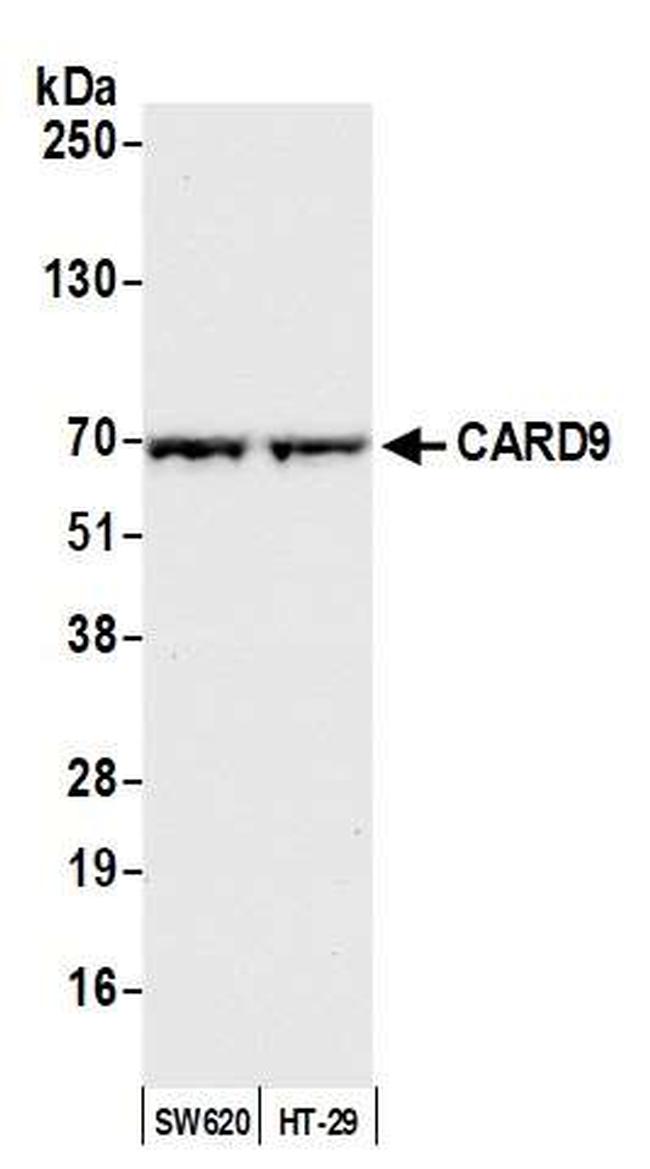 CARD9 Antibody in Western Blot (WB)