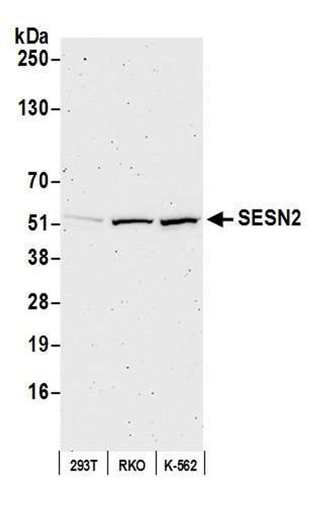SESN2 Antibody in Western Blot (WB)