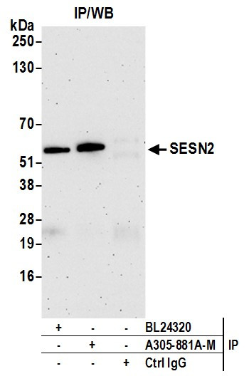 SESN2 Antibody in Immunoprecipitation (IP)