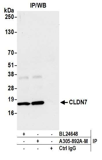 CLDN7 Antibody in Immunoprecipitation (IP)