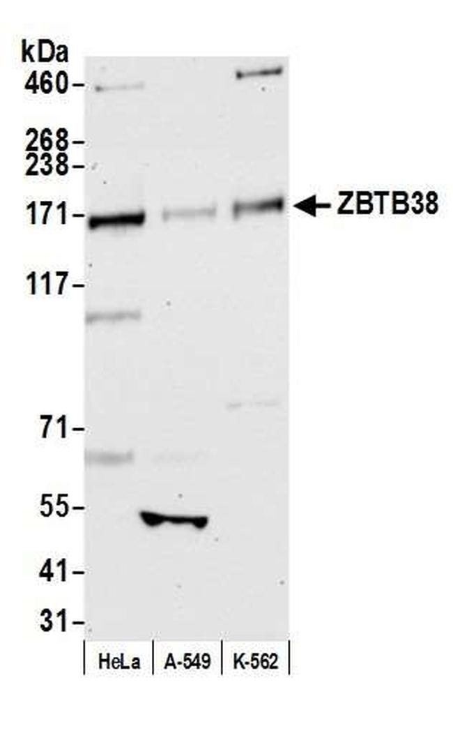 ZBTB38 Antibody in Western Blot (WB)