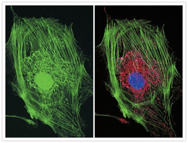 Mouse IgG (H+L) Cross-Adsorbed Secondary Antibody in Immunocytochemistry (ICC/IF)