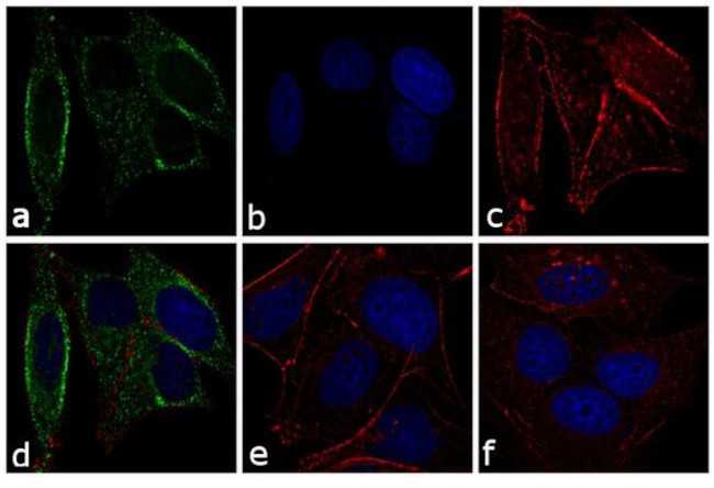 Mouse IgG (H+L) Secondary Antibody in Immunocytochemistry (ICC/IF)