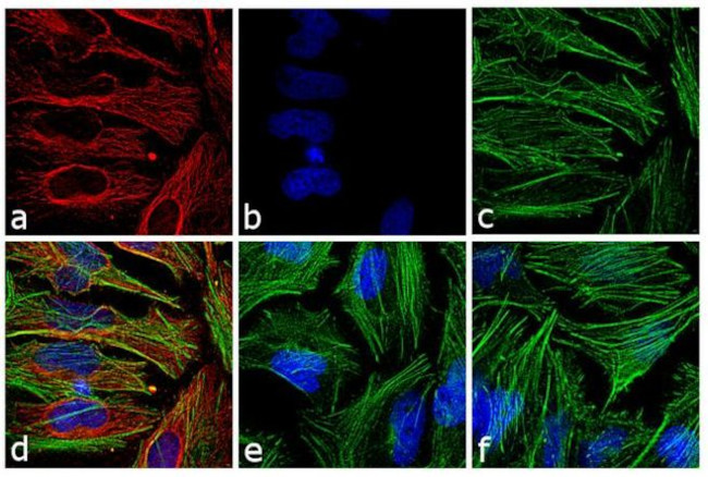 Mouse IgG (H+L) Highly Cross-Adsorbed Secondary Antibody in Immunocytochemistry (ICC/IF)