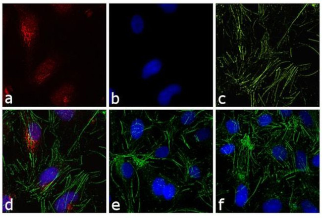 Rabbit IgG (H+L) Highly Cross-Adsorbed Secondary Antibody in Immunocytochemistry (ICC/IF)