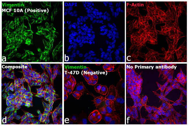 Mouse IgG (H+L) Highly Cross-Adsorbed Secondary Antibody in Immunocytochemistry (ICC/IF)