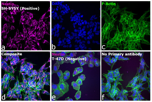 Mouse IgG (H+L) Highly Cross-Adsorbed Secondary Antibody in Immunocytochemistry (ICC/IF)