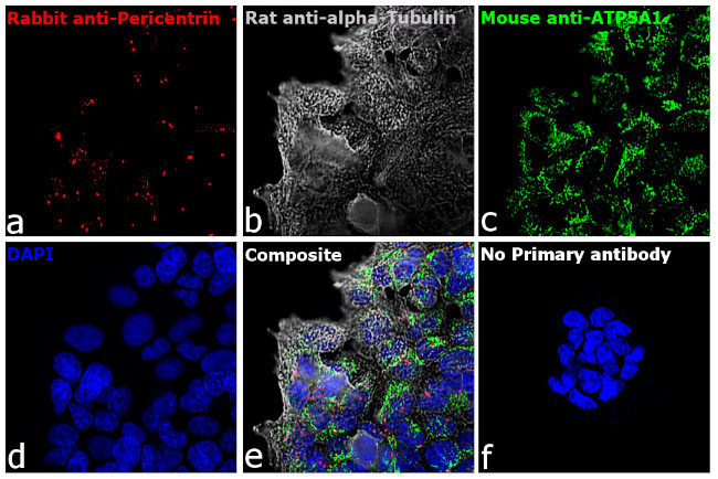 Mouse IgG (H+L) Highly Cross-Adsorbed Secondary Antibody in Immunocytochemistry (ICC/IF)