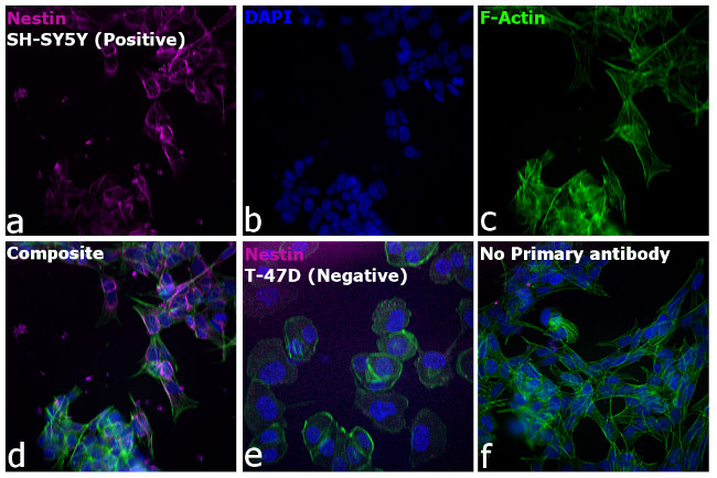 Mouse IgG (H+L) Highly Cross-Adsorbed Secondary Antibody in Immunocytochemistry (ICC/IF)