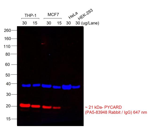 Rabbit IgG (H+L) Highly Cross-Adsorbed Secondary Antibody in Western Blot (WB)