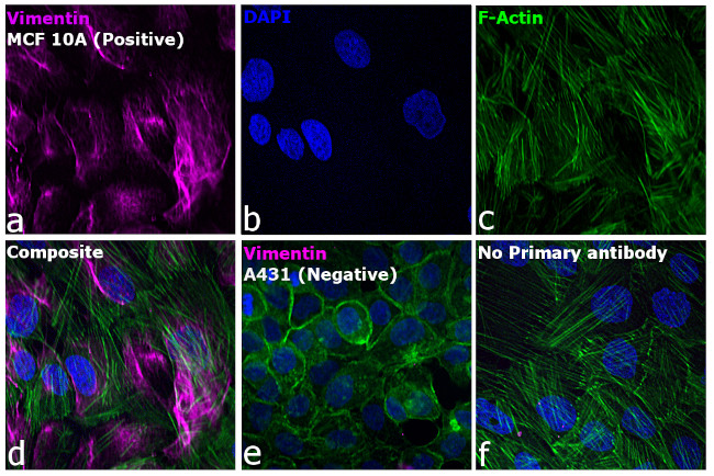 Rabbit IgG (H+L) Highly Cross-Adsorbed Secondary Antibody in Immunocytochemistry (ICC/IF)