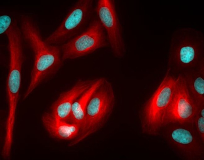 Rabbit IgG (H+L) Highly Cross-Adsorbed Secondary Antibody in Immunocytochemistry (ICC/IF)