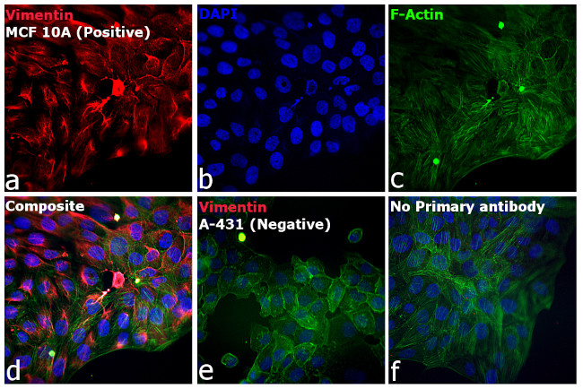 Rabbit IgG (H+L) Highly Cross-Adsorbed Secondary Antibody in Immunocytochemistry (ICC/IF)