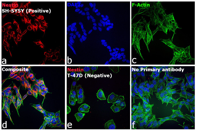 Mouse IgG (H+L) Highly Cross-Adsorbed Secondary Antibody in Immunocytochemistry (ICC/IF)