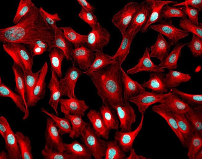 Mouse IgG (H+L) Highly Cross-Adsorbed Secondary Antibody in Immunocytochemistry (ICC/IF)