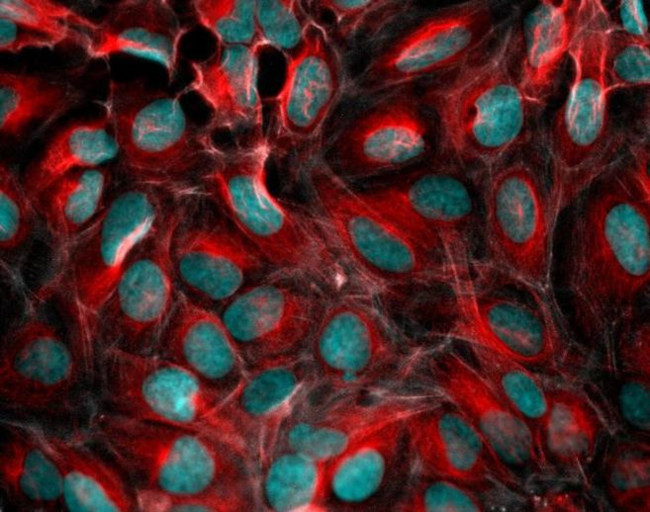 Mouse IgG (H+L) Highly Cross-Adsorbed Secondary Antibody in Immunocytochemistry (ICC/IF)