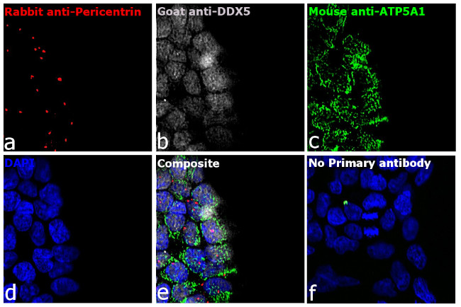 Mouse IgG (H+L) Highly Cross-Adsorbed Secondary Antibody in Immunocytochemistry (ICC/IF)