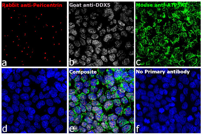 Rabbit IgG (H+L) Highly Cross-Adsorbed Secondary Antibody in Immunocytochemistry (ICC/IF)