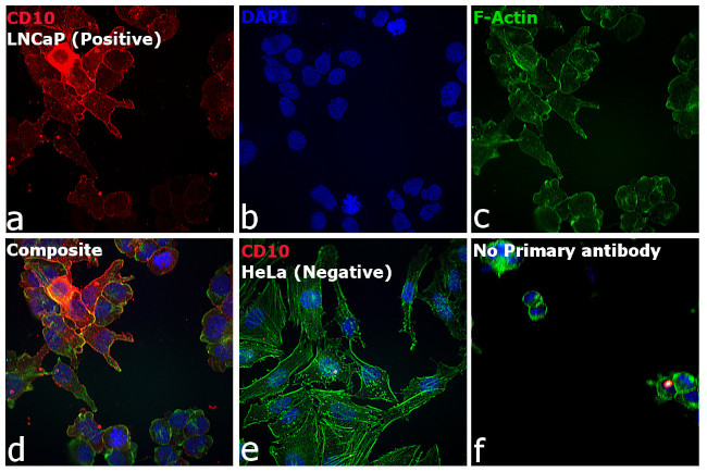 Goat IgG (H+L) Highly Cross-Adsorbed Secondary Antibody in Immunocytochemistry (ICC/IF)