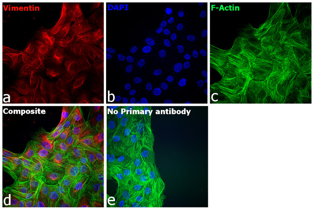 Chicken IgY (H+L) Cross-Adsorbed Secondary Antibody in Immunocytochemistry (ICC/IF)