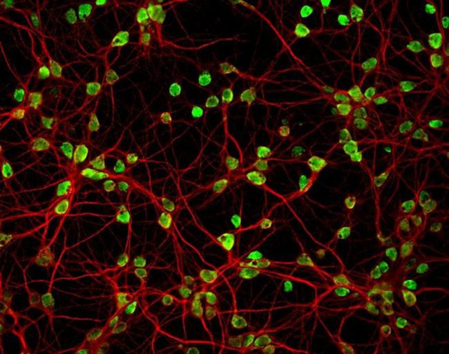 Mouse IgG (H+L) Highly Cross-Adsorbed Secondary Antibody in Immunocytochemistry (ICC/IF)