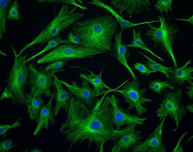 Mouse IgG (H+L) Highly Cross-Adsorbed Secondary Antibody in Immunocytochemistry (ICC/IF)