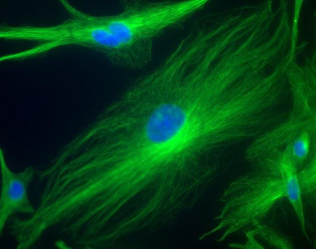 Mouse IgG (H+L) Highly Cross-Adsorbed Secondary Antibody in Immunocytochemistry (ICC/IF)