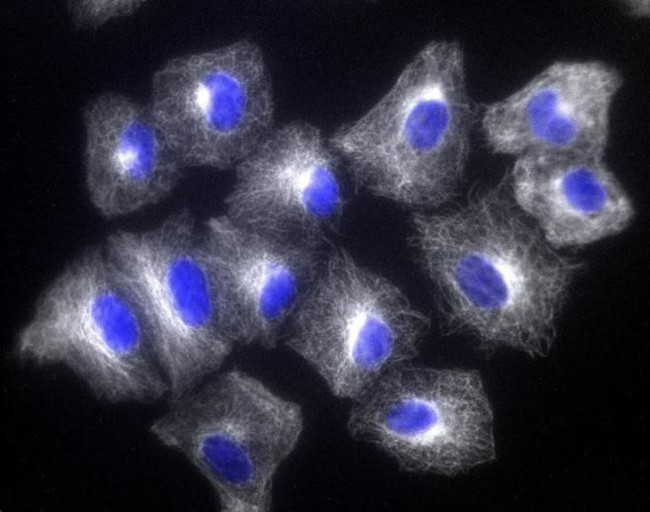 Mouse IgG (H+L) Highly Cross-Adsorbed Secondary Antibody in Immunocytochemistry (ICC/IF)