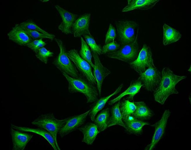 Rabbit IgG (H+L) Highly Cross-Adsorbed Secondary Antibody in Immunocytochemistry (ICC/IF)