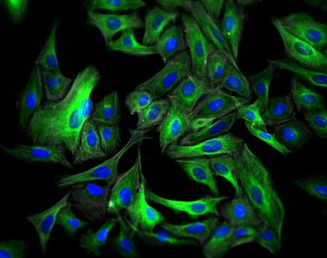 Rabbit IgG (H+L) Highly Cross-Adsorbed Secondary Antibody in Immunocytochemistry (ICC/IF)