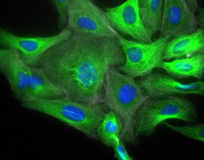 Rabbit IgG (H+L) Highly Cross-Adsorbed Secondary Antibody in Immunocytochemistry (ICC/IF)