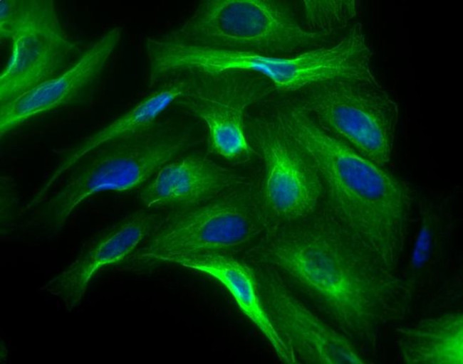 Rabbit IgG (H+L) Highly Cross-Adsorbed Secondary Antibody in Immunocytochemistry (ICC/IF)